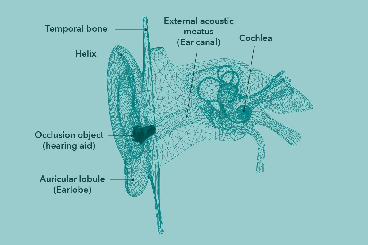 The occlusion effect: Causes & solutions | Miracle-Ear